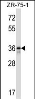 FETUB Antibody (C-term)