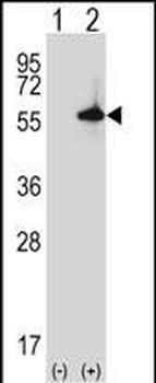 Mouse Sgk3 Antibody (C-term)