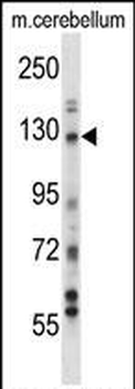 USP15 Antibody (N-term)