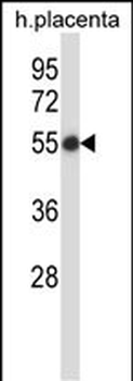 SMARCB1 Antibody (N-term)