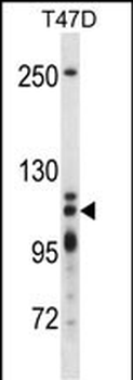 XRN2 Antibody (N-term)