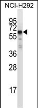 GFRA2 Antibody (C-term)