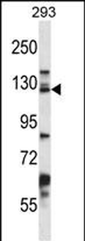 DSG2 Antibody (C-term)