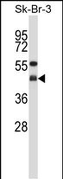 GNAI2 Antibody (N-term)