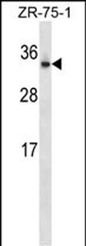 OTUB2 Antibody (N-term)
