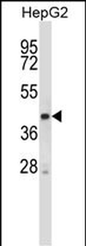 Mouse Stk25 Antibody (C-term)