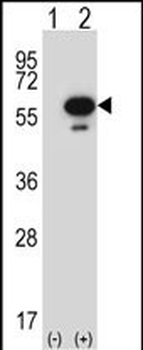 Mouse Stk25 Antibody (C-term)