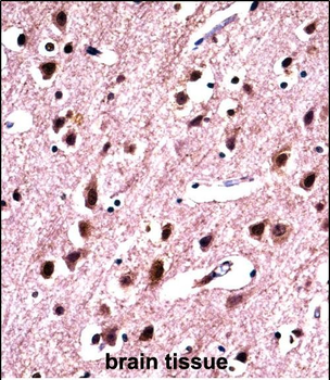 SNRPN Antibody (N-term)