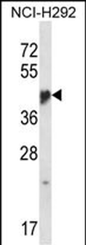 NR1I3 Antibody (Center)