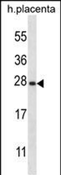 SNAP23 Antibody (C-term)