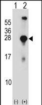 SNAP23 Antibody (C-term)