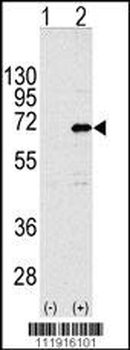 CNOT4 Antibody (N-term)