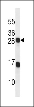 KDELR2 Antibody (C-term)