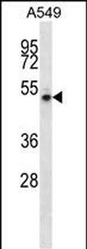 NUDCD1 Antibody (Center)