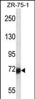 SP100 Antibody (N-term)