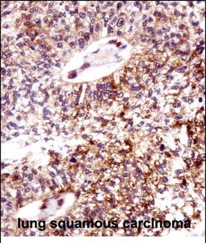 ECT2 Antibody (Center)