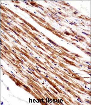 PLA2G5 Antibody (C-term)