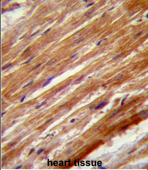 MEKK4 Antibody (Center C1081)