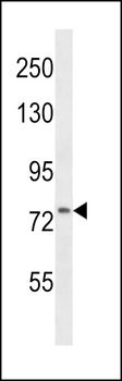 CD106 Antibody (Center)
