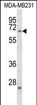 FZD2 Antibody (C-term)
