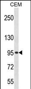 Mouse Adrbk2 Antibody (C-term)
