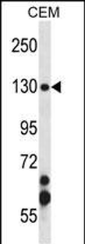 SMC3 Antibody (Center)