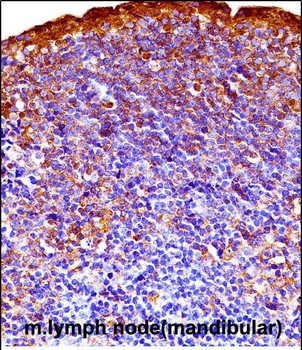 Mouse Gsk3a Antibody (C-term)