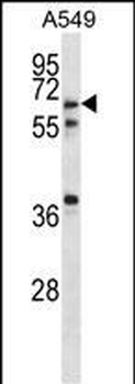 GLP2R Antibody (Center)