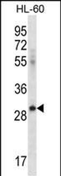 ICOSLG Antibody (C-term)