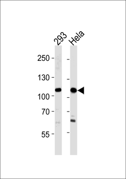 SALL4 Antibody (C-term)