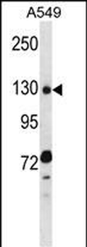 RBM5 Antibody (N-term)