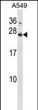 Mouse Hoxb7 Antibody (Center)