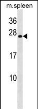 Mouse Hoxb7 Antibody (Center)