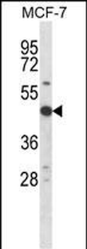 Mouse Rps6kb2 Antibody (C-term)