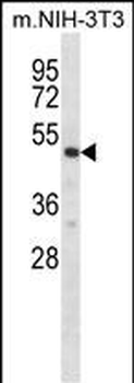 Mouse Rps6kb2 Antibody (C-term)