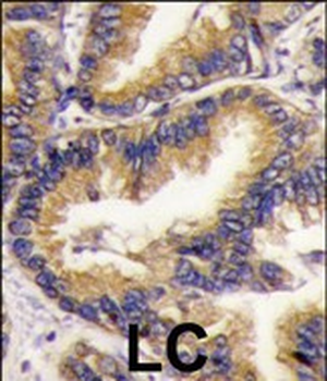 URM1 Antibody (N-term)