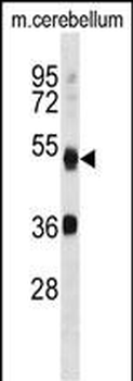 ATG4B Antibody (N-term)