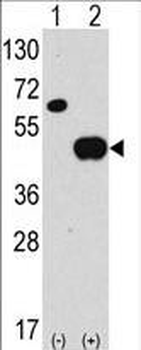 ATG4B Antibody (N-term)