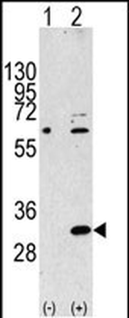 EIF4E2 Antibody (N-term)