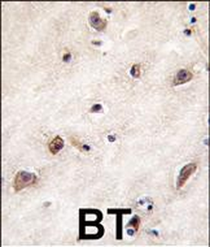 GDF1 Antibody (N-term)