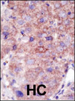 SMURF2 Antibody (C-term)