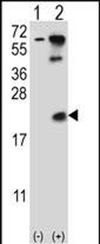 UBE2B Antibody (C-term)