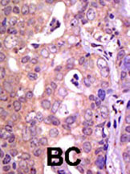 USP1 Antibody (C-term)