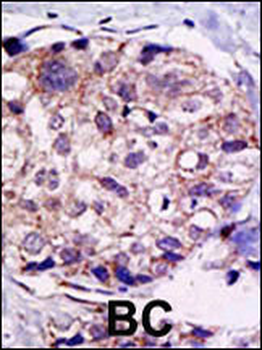 USP2 Antibody (C-term L523)