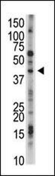 USP12 Antibody (N-term)