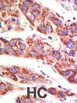 USP12 Antibody (N-term)