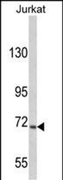 USP19 Antibody (C-term)