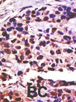 USP25 Antibody (C-term)