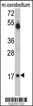 UBE2V1 Antibody (C-term)