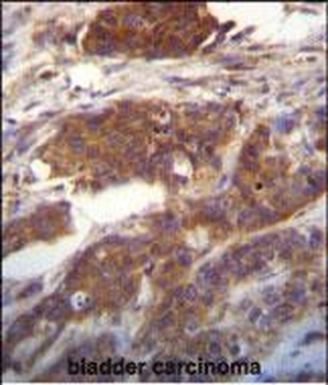 Ufc1 Antibody (C-term)